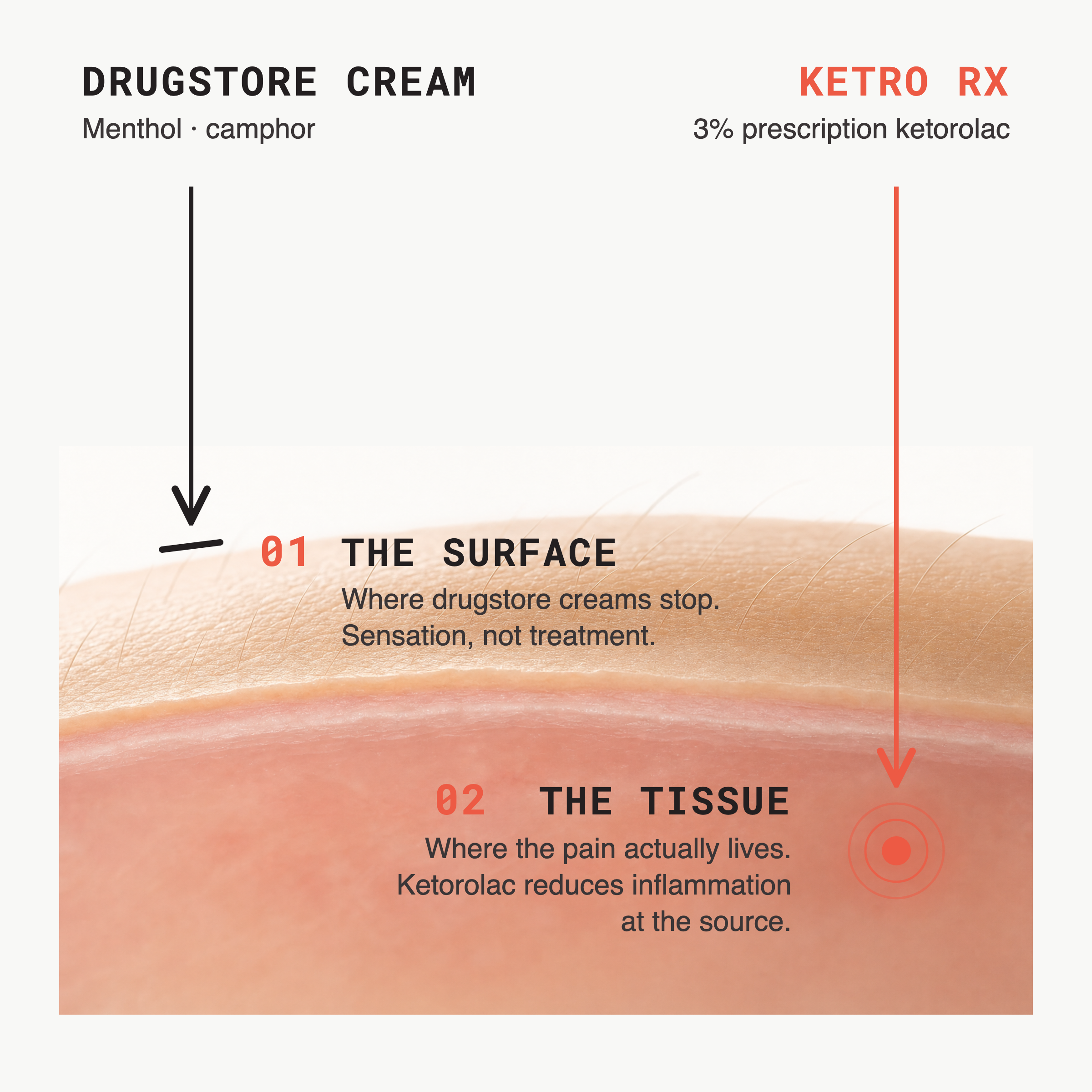 Two-layer relief system: drugstore creams stop at the skin surface, KETRO RX ketorolac reaches the inflamed tissue underneath